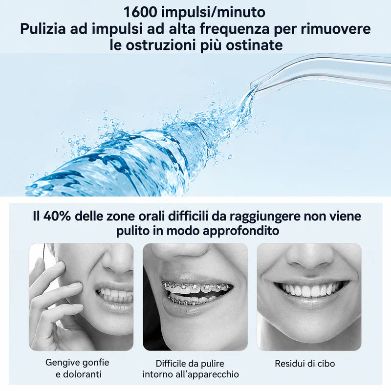 Idropulsore Dentale | Sorriso Sano ogni Giorno